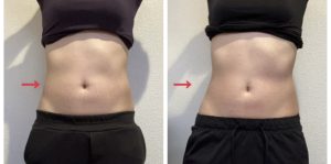 セルフエステ効果/ウエスト01