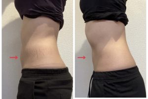 セルフエステ効果/ウエスト02